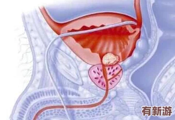 手腳綁起來拿刷子刷尿道孔的行為背后隱藏著怎樣的心理與動機(jī)